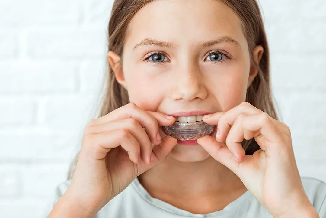 Myobrace for Children: A Natural Solution for Straight Teeth