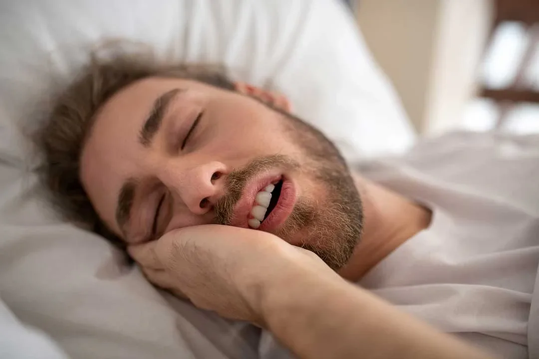 Orthognathic Surgery for Sleep Apnea