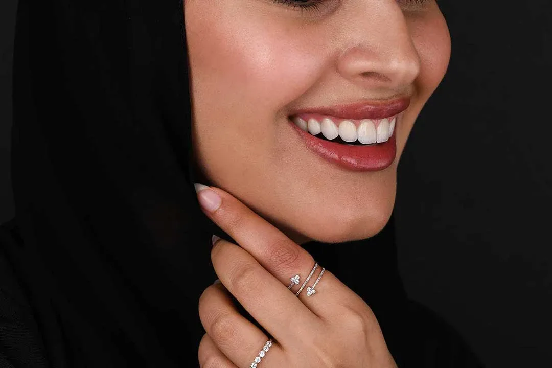 أهم 3 أشياء يجب مراعاتها قبل تحول الابتسامة