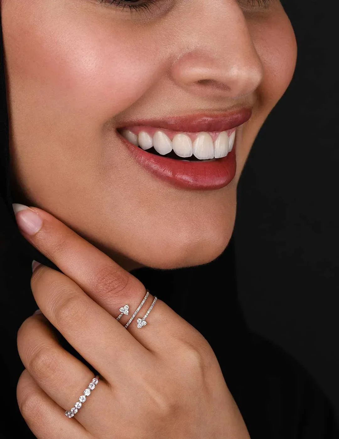 smile makeovers near me