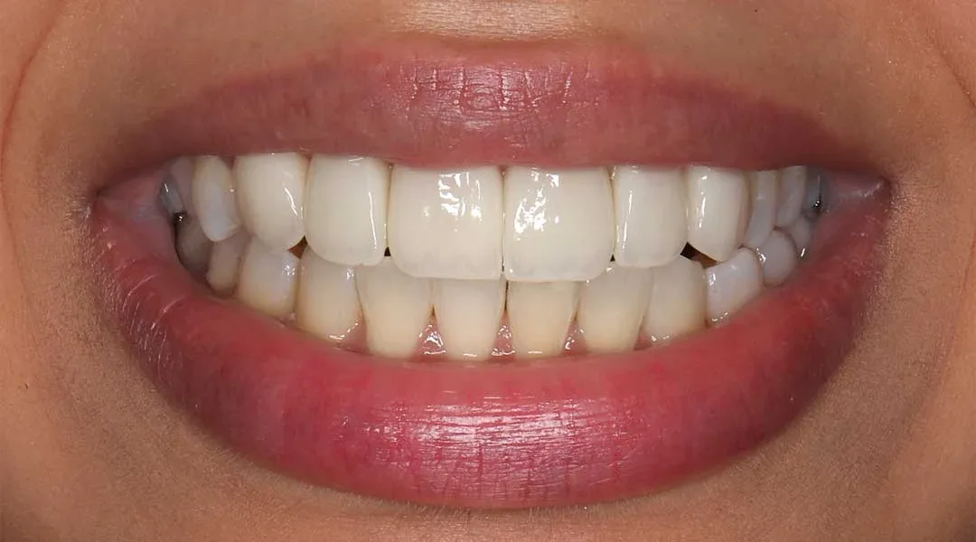 cosmetic dentist near me abu dhabi