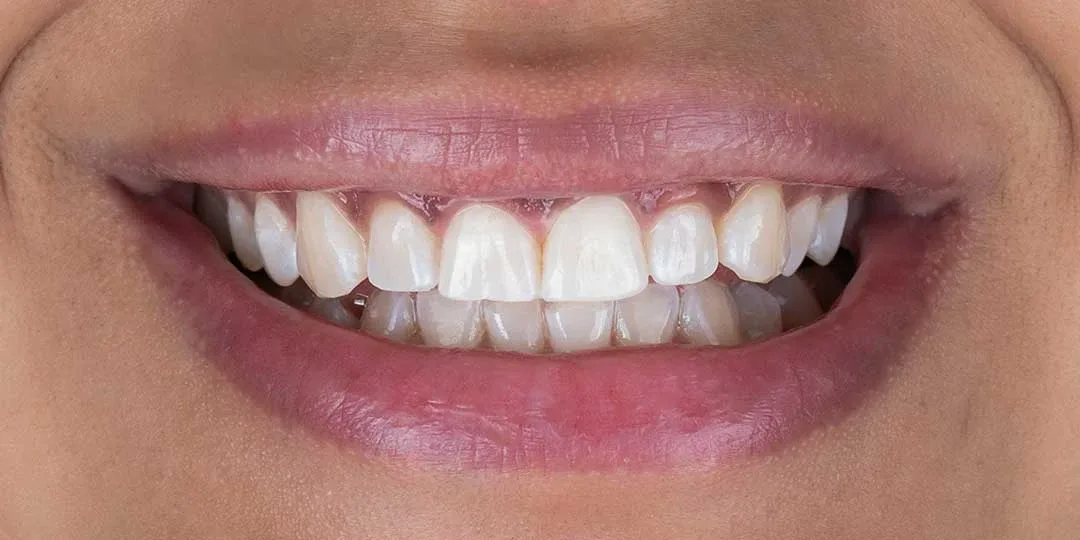 best cosmetic dentistry dubai