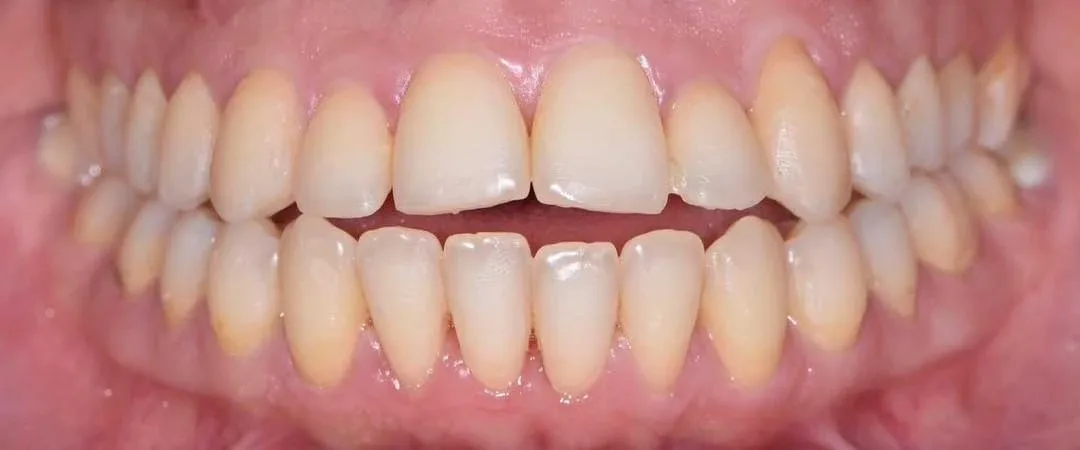 orthodontics near me