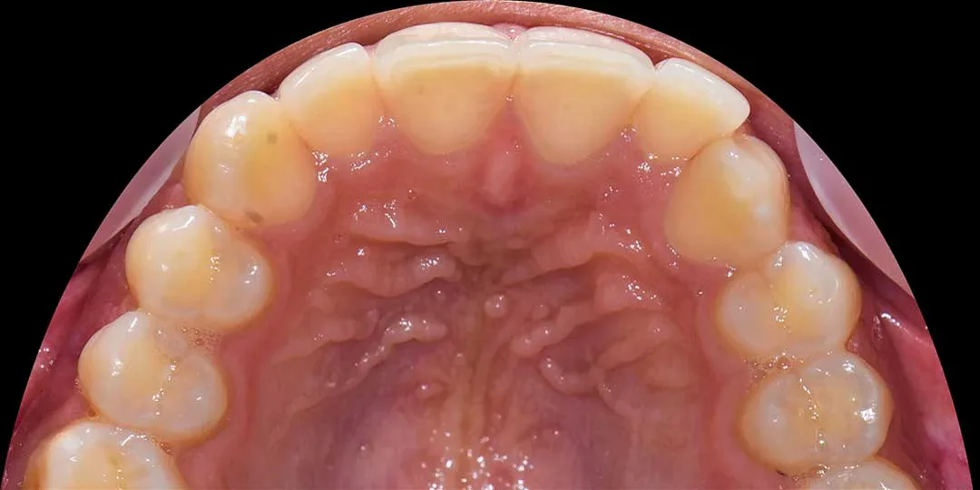 orthodontics abu dhabi