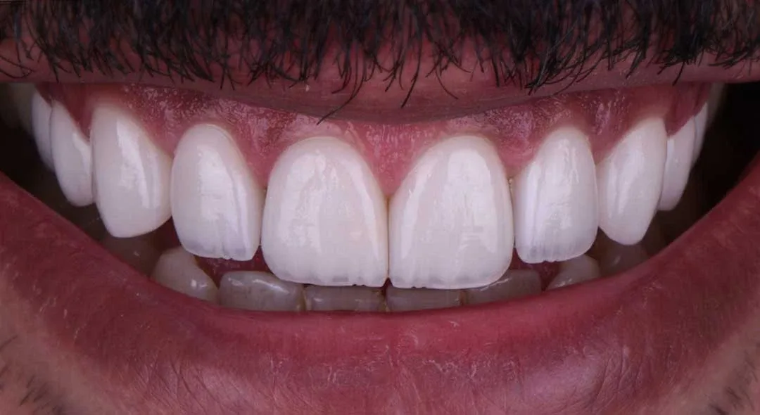 Prosthodontics near me