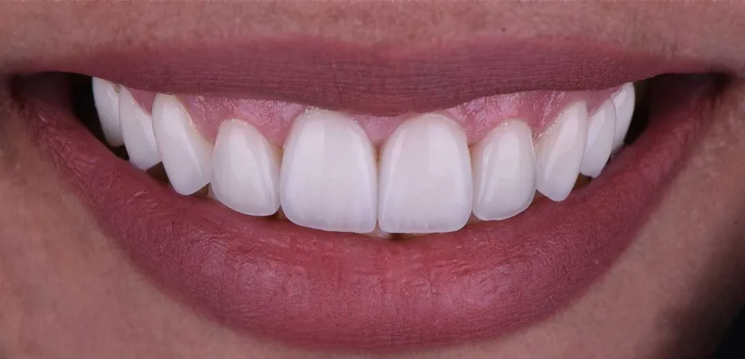 cosmetic dentist near me