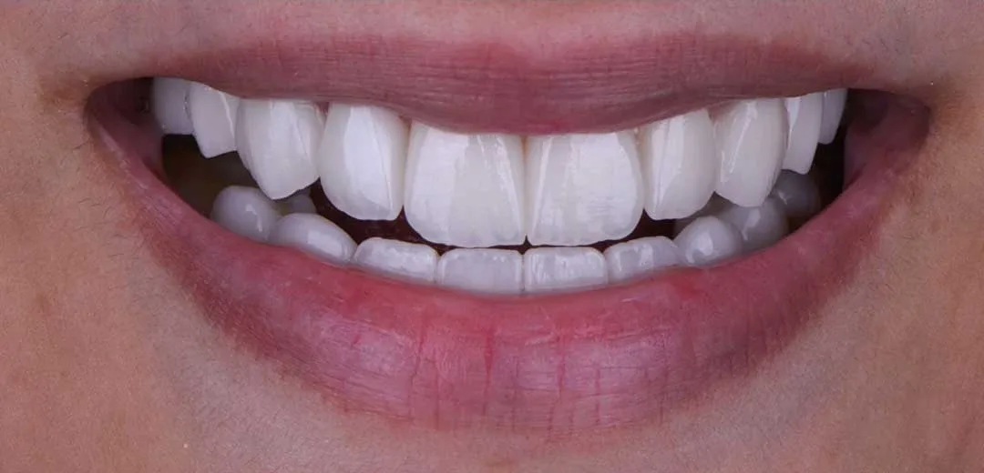 cosmetic dentist near me dubai