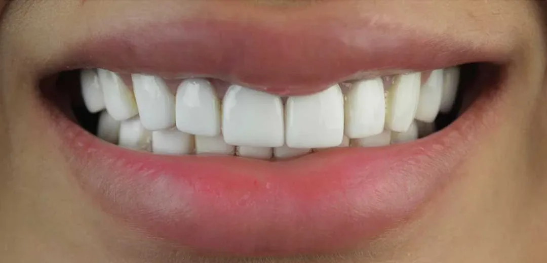 cosmetic dentist near me