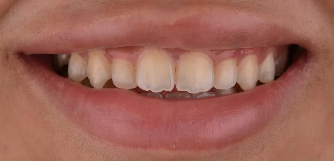 cosmetic dentist dubai