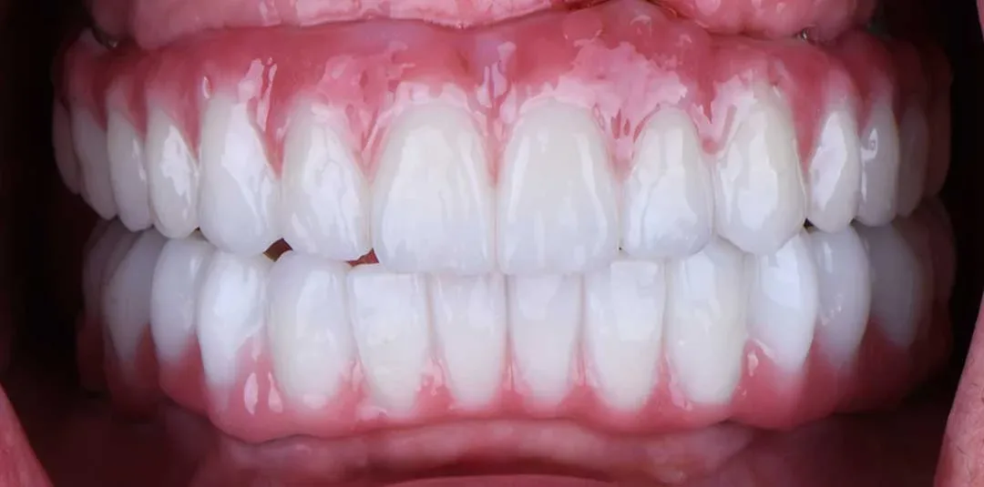 full mouth rehabilitation near me