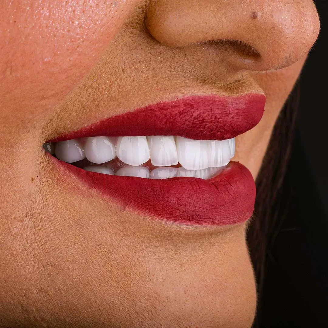 veneers abu dhabi