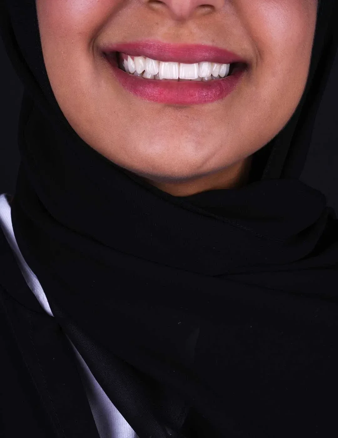dental implants abu dhabi