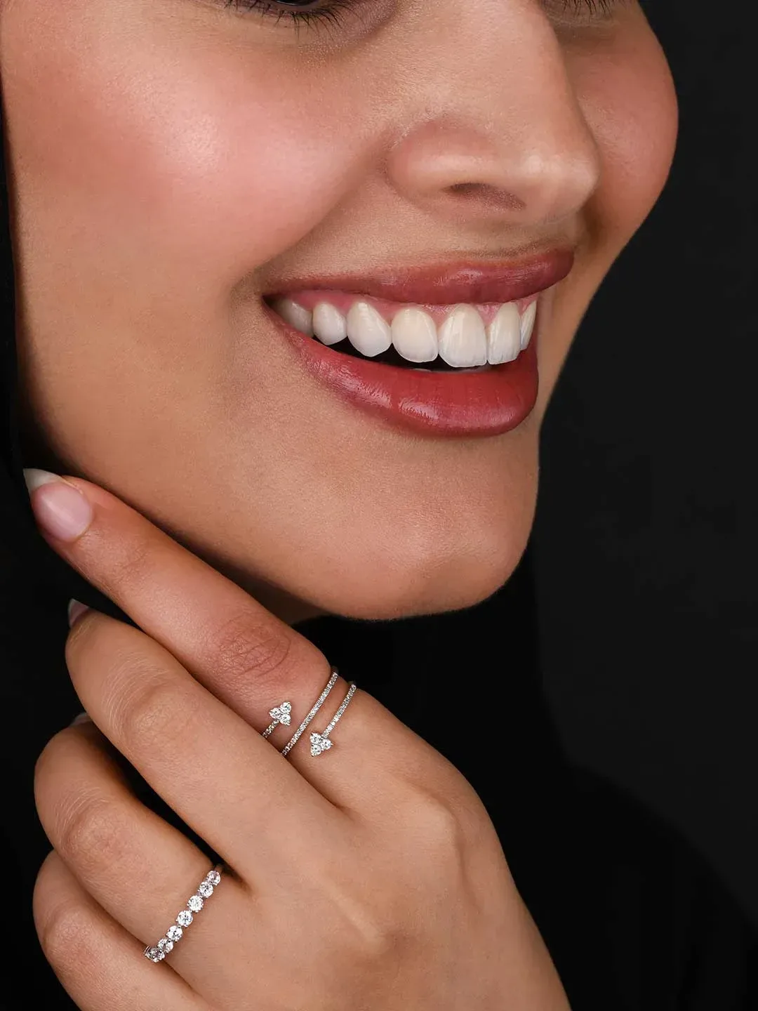 A photo showing half the face of a lady with beautiful natural looking porcelain veneers